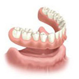 Имплантация при отсутствии всех зубов